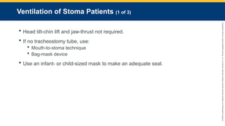 Copyright
©
2023
by
Jones
&
Bartlett
Learning,
LLC,
an
Ascend
Learning
Company
and
the
American
Academy
of
Orthopaedic
Surgeons.
Ventilation of Stoma Patients (1 of 3)
 Head tilt-chin lift and jaw-thrust not required.
 If no tracheostomy tube, use:
 Mouth-to-stoma technique
 Bag-mask device
 Use an infant- or child-sized mask to make an adequate seal.
 