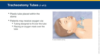 Copyright
©
2023
by
Jones
&
Bartlett
Learning,
LLC,
an
Ascend
Learning
Company
and
the
American
Academy
of
Orthopaedic
Surgeons.
Tracheostomy Tubes (1 of 2)
 Plastic tube placed within the
stoma
 Patients may receive oxygen via:
 Tubing designed to fit over the tube
 Placing an oxygen mask over the
tube
© Jones & Bartlett Learning.
 