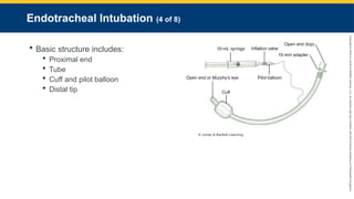 Copyright
©
2023
by
Jones
&
Bartlett
Learning,
LLC,
an
Ascend
Learning
Company
and
the
American
Academy
of
Orthopaedic
Surgeons.
Endotracheal Intubation (4 of 8)
 Basic structure includes:
 Proximal end
 Tube
 Cuff and pilot balloon
 Distal tip
© Jones & Bartlett Learning.
 