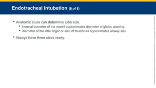 Copyright
©
2023
by
Jones
&
Bartlett
Learning,
LLC,
an
Ascend
Learning
Company
and
the
American
Academy
of
Orthopaedic
Surgeons.
Endotracheal Intubation (8 of 8)
 Anatomic clues can determine tube size.
 Internal diameter of the nostril approximates diameter of glottic opening.
 Diameter of the little finger or size of thumbnail approximates airway size.
 Always have three sizes ready.
 