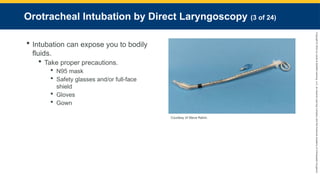 Copyright
©
2023
by
Jones
&
Bartlett
Learning,
LLC,
an
Ascend
Learning
Company
and
the
American
Academy
of
Orthopaedic
Surgeons.
Orotracheal Intubation by Direct Laryngoscopy (3 of 24)
 Intubation can expose you to bodily
fluids.
 Take proper precautions.
 N95 mask
 Safety glasses and/or full-face
shield
 Gloves
 Gown
Courtesy of Steve Rahm.
 