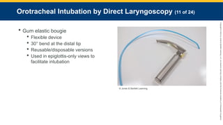 Copyright
©
2023
by
Jones
&
Bartlett
Learning,
LLC,
an
Ascend
Learning
Company
and
the
American
Academy
of
Orthopaedic
Surgeons.
Orotracheal Intubation by Direct Laryngoscopy (11 of 24)
 Gum elastic bougie
 Flexible device
 30° bend at the distal tip
 Reusable/disposable versions
 Used in epiglottis-only views to
facilitate intubation
© Jones & Bartlett Learning.
 