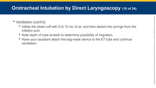 Copyright
©
2023
by
Jones
&
Bartlett
Learning,
LLC,
an
Ascend
Learning
Company
and
the
American
Academy
of
Orthopaedic
Surgeons.
Orotracheal Intubation by Direct Laryngoscopy (16 of 24)
 Ventilation (cont’d)
 Inflate the distal cuff with 5 to 10 mL of air, and then detach the syringe from the
inflation port.
 Note depth of tube at teeth to determine possibility of migration.
 Have your assistant attach the bag-mask device to the ET tube and continue
ventilation.
 