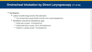Copyright
©
2023
by
Jones
&
Bartlett
Learning,
LLC,
an
Ascend
Learning
Company
and
the
American
Academy
of
Orthopaedic
Surgeons.
Orotracheal Intubation by Direct Laryngoscopy (17 of 24)
 Ventilation
 Listen to both lungs and to the stomach.
 You should hear equal breath sounds and a quiet epigastrium.
 Ventilation should be dictated by age.
 Adult with a pulse: 10 breaths/min
 Infant/child with a pulse: 20 to 30 breaths/min
 Patient in cardiac arrest: 10 breaths/min
 