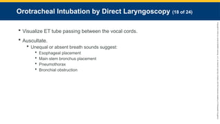 Copyright
©
2023
by
Jones
&
Bartlett
Learning,
LLC,
an
Ascend
Learning
Company
and
the
American
Academy
of
Orthopaedic
Surgeons.
Orotracheal Intubation by Direct Laryngoscopy (18 of 24)
 Visualize ET tube passing between the vocal cords.
 Auscultate.
 Unequal or absent breath sounds suggest:
 Esophageal placement
 Main stem bronchus placement
 Pneumothorax
 Bronchial obstruction
 