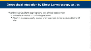 Copyright
©
2023
by
Jones
&
Bartlett
Learning,
LLC,
an
Ascend
Learning
Company
and
the
American
Academy
of
Orthopaedic
Surgeons.
Orotracheal Intubation by Direct Laryngoscopy (21 of 24)
 Continuous waveform capnography plus clinical assessment
 Most reliable method of confirming placement
 Attach in-line capnography monitor when bag-mask device is attached to the ET
tube.
 