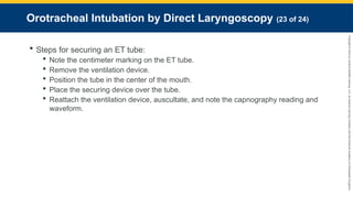 Copyright
©
2023
by
Jones
&
Bartlett
Learning,
LLC,
an
Ascend
Learning
Company
and
the
American
Academy
of
Orthopaedic
Surgeons.
Orotracheal Intubation by Direct Laryngoscopy (23 of 24)
 Steps for securing an ET tube:
 Note the centimeter marking on the ET tube.
 Remove the ventilation device.
 Position the tube in the center of the mouth.
 Place the securing device over the tube.
 Reattach the ventilation device, auscultate, and note the capnography reading and
waveform.
 