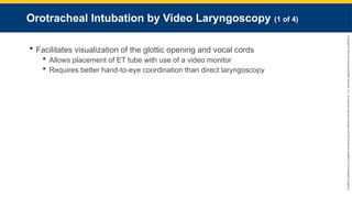 Copyright
©
2023
by
Jones
&
Bartlett
Learning,
LLC,
an
Ascend
Learning
Company
and
the
American
Academy
of
Orthopaedic
Surgeons.
Orotracheal Intubation by Video Laryngoscopy (1 of 4)
 Facilitates visualization of the glottic opening and vocal cords
 Allows placement of ET tube with use of a video monitor
 Requires better hand-to-eye coordination than direct laryngoscopy
 