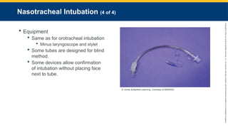 Copyright
©
2023
by
Jones
&
Bartlett
Learning,
LLC,
an
Ascend
Learning
Company
and
the
American
Academy
of
Orthopaedic
Surgeons.
Nasotracheal Intubation (4 of 4)
 Equipment
 Same as for orotracheal intubation
 Minus laryngoscope and stylet
 Some tubes are designed for blind
method.
 Some devices allow confirmation
of intubation without placing face
next to tube.
© Jones & Bartlett Learning. Courtesy of MIEMSS.
 