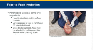 Copyright
©
2023
by
Jones
&
Bartlett
Learning,
LLC,
an
Ascend
Learning
Company
and
the
American
Academy
of
Orthopaedic
Surgeons.
Face-to-Face Intubation
 Paramedic’s face is at same level
as patient’s.
 Head is stabilized, not in sniffing
position.
 Laryngoscope is held in right hand;
ET tube in left hand
 Once blade is placed, head may
be adjusted by pulling mandible
forward while pressing down.
© Jones & Bartlett Learning.
 