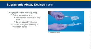 Copyright
©
2023
by
Jones
&
Bartlett
Learning,
LLC,
an
Ascend
Learning
Company
and
the
American
Academy
of
Orthopaedic
Surgeons.
Supraglottic Airway Devices (8 of 19)
 Laryngeal mask airway (LMA)
 Option for patients who:
 Require more support than bag-
mask
 Do not require ET intubation
 Conduit from glottic opening to
ventilation device
© Jones & Bartlett Learning.
 