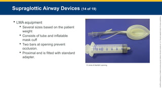 Copyright
©
2023
by
Jones
&
Bartlett
Learning,
LLC,
an
Ascend
Learning
Company
and
the
American
Academy
of
Orthopaedic
Surgeons.
Supraglottic Airway Devices (14 of 19)
 LMA equipment
 Several sizes based on the patient
weight
 Consists of tube and inflatable
mask cuff
 Two bars at opening prevent
occlusion.
 Proximal end is fitted with standard
adapter.
© Jones & Bartlett Learning.
 