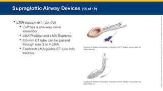 Copyright
©
2023
by
Jones
&
Bartlett
Learning,
LLC,
an
Ascend
Learning
Company
and
the
American
Academy
of
Orthopaedic
Surgeons.
Supraglottic Airway Devices (15 of 19)
 LMA equipment (cont’d)
 Cuff has a one-way valve
assembly.
 LMA ProSeal and LMA Supreme
 6.0-mm ET tube can be passed
through size 3 or 4 LMA.
 Fasttrach LMA guides ET tube into
trachea.
Property of Teleflex Incorporated. Copyright © 2017 Teleflex Incorporated. All
rights reserved.
Property of Teleflex Incorporated. Copyright © 2017 Teleflex Incorporated. All
rights reserved.
 