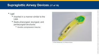 Copyright
©
2023
by
Jones
&
Bartlett
Learning,
LLC,
an
Ascend
Learning
Company
and
the
American
Academy
of
Orthopaedic
Surgeons.
Supraglottic Airway Devices (17 of 19)
 i-gel
 Inserted in a manner similar to the
LMA
 Seals pharyngeal, laryngeal, and
perilaryngeal structures
 Avoids compression trauma
© Photo Researchers, Inc./Science Source.
 