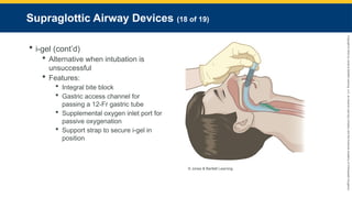 Copyright
©
2023
by
Jones
&
Bartlett
Learning,
LLC,
an
Ascend
Learning
Company
and
the
American
Academy
of
Orthopaedic
Surgeons.
Supraglottic Airway Devices (18 of 19)
 i-gel (cont’d)
 Alternative when intubation is
unsuccessful
 Features:
 Integral bite block
 Gastric access channel for
passing a 12-Fr gastric tube
 Supplemental oxygen inlet port for
passive oxygenation
 Support strap to secure i-gel in
position
© Jones & Bartlett Learning.
 