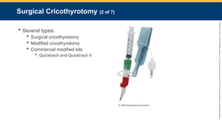 Copyright
©
2023
by
Jones
&
Bartlett
Learning,
LLC,
an
Ascend
Learning
Company
and
the
American
Academy
of
Orthopaedic
Surgeons.
Surgical Cricothyrotomy (2 of 7)
 Several types:
 Surgical cricothyrotomy
 Modified cricothyrotomy
 Commercial modified kits
 Quicktrach and Quicktrach II
© VBM Medizintechnik GmbH.
 