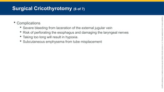 Copyright
©
2023
by
Jones
&
Bartlett
Learning,
LLC,
an
Ascend
Learning
Company
and
the
American
Academy
of
Orthopaedic
Surgeons.
Surgical Cricothyrotomy (6 of 7)
 Complications
 Severe bleeding from laceration of the external jugular vein
 Risk of perforating the esophagus and damaging the laryngeal nerves
 Taking too long will result in hypoxia.
 Subcutaneous emphysema from tube misplacement
 