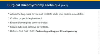 Copyright
©
2023
by
Jones
&
Bartlett
Learning,
LLC,
an
Ascend
Learning
Company
and
the
American
Academy
of
Orthopaedic
Surgeons.
Surgical Cricothyrotomy Technique (3 of 3)
 Attach the bag-mask device and ventilate while your partner auscultates.
 Confirm proper tube placement.
 Ensure bleeding has been controlled.
 Secure tube and continue to ventilate.
 Refer to Skill Drill 16-16: Performing a Surgical Cricothyrotomy
 