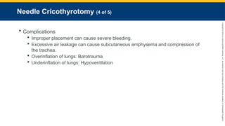 Copyright
©
2023
by
Jones
&
Bartlett
Learning,
LLC,
an
Ascend
Learning
Company
and
the
American
Academy
of
Orthopaedic
Surgeons.
Needle Cricothyrotomy (4 of 5)
 Complications
 Improper placement can cause severe bleeding.
 Excessive air leakage can cause subcutaneous emphysema and compression of
the trachea.
 Overinflation of lungs: Barotrauma
 Underinflation of lungs: Hypoventilation
 