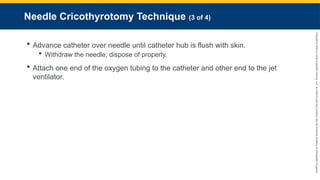 Copyright
©
2023
by
Jones
&
Bartlett
Learning,
LLC,
an
Ascend
Learning
Company
and
the
American
Academy
of
Orthopaedic
Surgeons.
Needle Cricothyrotomy Technique (3 of 4)
 Advance catheter over needle until catheter hub is flush with skin.
 Withdraw the needle; dispose of properly.
 Attach one end of the oxygen tubing to the catheter and other end to the jet
ventilator.
 