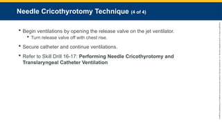 Copyright
©
2023
by
Jones
&
Bartlett
Learning,
LLC,
an
Ascend
Learning
Company
and
the
American
Academy
of
Orthopaedic
Surgeons.
Needle Cricothyrotomy Technique (4 of 4)
 Begin ventilations by opening the release valve on the jet ventilator.
 Turn release valve off with chest rise.
 Secure catheter and continue ventilations.
 Refer to Skill Drill 16-17: Performing Needle Cricothyrotomy and
Translaryngeal Catheter Ventilation
 
