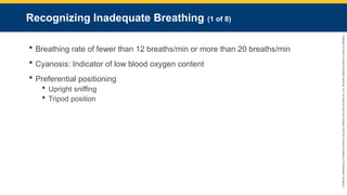 Copyright
©
2023
by
Jones
&
Bartlett
Learning,
LLC,
an
Ascend
Learning
Company
and
the
American
Academy
of
Orthopaedic
Surgeons.
Recognizing Inadequate Breathing (1 of 8)
 Breathing rate of fewer than 12 breaths/min or more than 20 breaths/min
 Cyanosis: Indicator of low blood oxygen content
 Preferential positioning
 Upright sniffing
 Tripod position
 