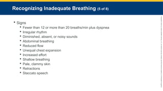 Copyright
©
2023
by
Jones
&
Bartlett
Learning,
LLC,
an
Ascend
Learning
Company
and
the
American
Academy
of
Orthopaedic
Surgeons.
Recognizing Inadequate Breathing (5 of 8)
 Signs
 Fewer than 12 or more than 20 breaths/min plus dyspnea
 Irregular rhythm
 Diminished, absent, or noisy sounds
 Abdominal breathing
 Reduced flow
 Unequal chest expansion
 Increased effort
 Shallow breathing
 Pale, clammy skin
 Retractions
 Staccato speech
 