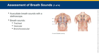 Copyright
©
2023
by
Jones
&
Bartlett
Learning,
LLC,
an
Ascend
Learning
Company
and
the
American
Academy
of
Orthopaedic
Surgeons.
Assessment of Breath Sounds (1 of 4)
 Auscultate breath sounds with a
stethoscope.
 Breath sounds:
 Tracheal
 Vesicular
 Bronchovesicular
© Jones & Bartlett Learning.
 