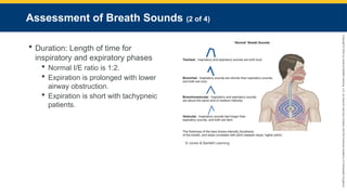 Copyright
©
2023
by
Jones
&
Bartlett
Learning,
LLC,
an
Ascend
Learning
Company
and
the
American
Academy
of
Orthopaedic
Surgeons.
Assessment of Breath Sounds (2 of 4)
 Duration: Length of time for
inspiratory and expiratory phases
 Normal I/E ratio is 1:2.
 Expiration is prolonged with lower
airway obstruction.
 Expiration is short with tachypneic
patients.
© Jones & Bartlett Learning.
 