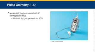 Copyright
©
2023
by
Jones
&
Bartlett
Learning,
LLC,
an
Ascend
Learning
Company
and
the
American
Academy
of
Orthopaedic
Surgeons.
Pulse Oximetry (1 of 4)
 Measures oxygen saturation of
hemoglobin (Hb)
 Normal: Spo2 of greater than 95%
© Jones & Bartlett Learning.
 