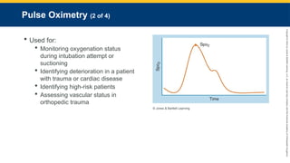 Copyright
©
2023
by
Jones
&
Bartlett
Learning,
LLC,
an
Ascend
Learning
Company
and
the
American
Academy
of
Orthopaedic
Surgeons.
Pulse Oximetry (2 of 4)
 Used for:
 Monitoring oxygenation status
during intubation attempt or
suctioning
 Identifying deterioration in a patient
with trauma or cardiac disease
 Identifying high-risk patients
 Assessing vascular status in
orthopedic trauma
© Jones & Bartlett Learning.
 