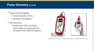 Copyright
©
2023
by
Jones
&
Bartlett
Learning,
LLC,
an
Ascend
Learning
Company
and
the
American
Academy
of
Orthopaedic
Surgeons.
Pulse Oximetry (4 of 4)
 Types of hemoglobin
 Oxyhemoglobin (HbO2)
 Reduced hemoglobin
 CO-oximeter
 Determines HbO2 saturation
(percentage of oxygenated Hb
compared with total hemoglobin)
The Masimo Rad-ST Pulse CO-Oximeter courtesy of Masimo Corporation (www.masimo.com).
 
