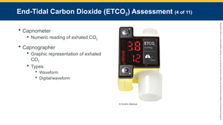 Copyright
©
2023
by
Jones
&
Bartlett
Learning,
LLC,
an
Ascend
Learning
Company
and
the
American
Academy
of
Orthopaedic
Surgeons.
End-Tidal Carbon Dioxide (ETCO2) Assessment (4 of 11)
 Capnometer
 Numeric reading of exhaled CO2
 Capnographer
 Graphic representation of exhaled
CO2
 Types:
 Waveform
 Digital/waveform
© Smiths Medical.
 