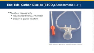 Copyright
©
2023
by
Jones
&
Bartlett
Learning,
LLC,
an
Ascend
Learning
Company
and
the
American
Academy
of
Orthopaedic
Surgeons.
End-Tidal Carbon Dioxide (ETCO2) Assessment (5 of 11)
 Waveform capnography
 Provides real-time CO2 information
 Displays a graphic waveform
© 2021 Medtronic. All rights reserved. Used with the permission of Medtronic.
 