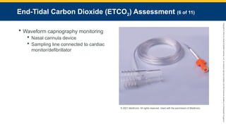 Copyright
©
2023
by
Jones
&
Bartlett
Learning,
LLC,
an
Ascend
Learning
Company
and
the
American
Academy
of
Orthopaedic
Surgeons.
End-Tidal Carbon Dioxide (ETCO2) Assessment (6 of 11)
 Waveform capnography monitoring
 Nasal cannula device
 Sampling line connected to cardiac
monitor/defibrillator
© 2021 Medtronic. All rights reserved. Used with the permission of Medtronic.
 