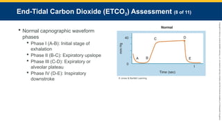 Copyright
©
2023
by
Jones
&
Bartlett
Learning,
LLC,
an
Ascend
Learning
Company
and
the
American
Academy
of
Orthopaedic
Surgeons.
End-Tidal Carbon Dioxide (ETCO2) Assessment (8 of 11)
 Normal capnographic waveform
phases
 Phase I (A-B): Initial stage of
exhalation
 Phase II (B-C): Expiratory upslope
 Phase III (C-D): Expiratory or
alveolar plateau
 Phase IV (D-E): Inspiratory
downstroke © Jones & Bartlett Learning.
 