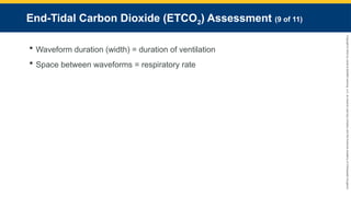 Copyright
©
2023
by
Jones
&
Bartlett
Learning,
LLC,
an
Ascend
Learning
Company
and
the
American
Academy
of
Orthopaedic
Surgeons.
End-Tidal Carbon Dioxide (ETCO2) Assessment (9 of 11)
 Waveform duration (width) = duration of ventilation
 Space between waveforms = respiratory rate
 