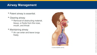 Copyright
©
2023
by
Jones
&
Bartlett
Learning,
LLC,
an
Ascend
Learning
Company
and
the
American
Academy
of
Orthopaedic
Surgeons.
Airway Management
 Patent airway is essential.
 Clearing airway
 Removal of obstructing material,
tissue, or fluids from the nose,
mouth, and throat
 Maintaining airway
 Air can enter and leave lungs
freely.
© Jones & Bartlett Learning.
 