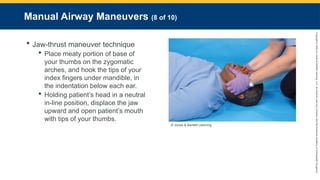 Copyright
©
2023
by
Jones
&
Bartlett
Learning,
LLC,
an
Ascend
Learning
Company
and
the
American
Academy
of
Orthopaedic
Surgeons.
Manual Airway Maneuvers (8 of 10)
 Jaw-thrust maneuver technique
 Place meaty portion of base of
your thumbs on the zygomatic
arches, and hook the tips of your
index fingers under mandible, in
the indentation below each ear.
 Holding patient’s head in a neutral
in-line posi­
tion, displace the jaw
upward and open patient’s mouth
with tips of your thumbs.
© Jones & Bartlett Learning.
 