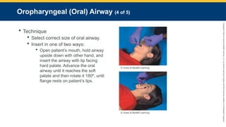 Copyright
©
2023
by
Jones
&
Bartlett
Learning,
LLC,
an
Ascend
Learning
Company
and
the
American
Academy
of
Orthopaedic
Surgeons.
Oropharyngeal (Oral) Airway (4 of 5)
 Technique
 Select correct size of oral airway.
 Insert in one of two ways:
 Open patient’s mouth, hold airway
upside down with other hand, and
insert the airway with tip facing
hard palate. Advance the oral
airway until it reaches the soft
palate and then rotate it 180º, until
flange rests on patient’s lips.
© Jones & Bartlett Learning.
© Jones & Bartlett Learning.
 
