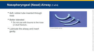 Copyright
©
2023
by
Jones
&
Bartlett
Learning,
LLC,
an
Ascend
Learning
Company
and
the
American
Academy
of
Orthopaedic
Surgeons.
Nasopharyngeal (Nasal) Airway (1 of 4)
 Soft, rubber tube inserted through
nose
 Better tolerated
 Do not use with trauma to the nose
or skull fracture.
 Lubricate the airway and insert
gently.
© Jones & Bartlett Learning.
 