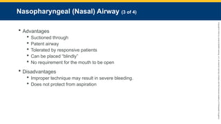 Copyright
©
2023
by
Jones
&
Bartlett
Learning,
LLC,
an
Ascend
Learning
Company
and
the
American
Academy
of
Orthopaedic
Surgeons.
Nasopharyngeal (Nasal) Airway (3 of 4)
 Advantages
 Suctioned through
 Patent airway
 Tolerated by responsive patients
 Can be placed “blindly”
 No requirement for the mouth to be open
 Disadvantages
 Improper technique may result in severe bleeding.
 Does not protect from aspiration
 