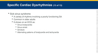 Copyright
©
2023
by
Jones
&
Bartlett
Learning,
LLC,
an
Ascend
Learning
Company
and
the
American
Academy
of
Orthopaedic
Surgeons.
Specific Cardiac Dysrhythmias (13 of 13)
 Sick sinus syndrome
 A variety of rhythms involving a poorly functioning SA
 Common in older adults
 It shows on an ECG as:
 Sinus bradycardia
 Sinus arrest
 SA block
 Alternating patterns of bradycardia and tachycardia
 