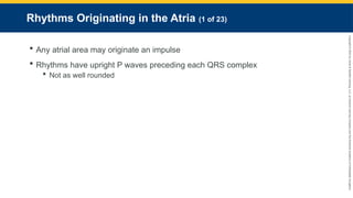 Copyright
©
2023
by
Jones
&
Bartlett
Learning,
LLC,
an
Ascend
Learning
Company
and
the
American
Academy
of
Orthopaedic
Surgeons.
Rhythms Originating in the Atria (1 of 23)
 Any atrial area may originate an impulse
 Rhythms have upright P waves preceding each QRS complex
 Not as well rounded
 