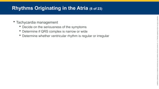 Copyright
©
2023
by
Jones
&
Bartlett
Learning,
LLC,
an
Ascend
Learning
Company
and
the
American
Academy
of
Orthopaedic
Surgeons.
Rhythms Originating in the Atria (6 of 23)
 Tachycardia management
 Decide on the seriousness of the symptoms
 Determine if QRS complex is narrow or wide
 Determine whether ventricular rhythm is regular or irregular
 