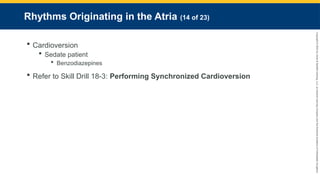 Copyright
©
2023
by
Jones
&
Bartlett
Learning,
LLC,
an
Ascend
Learning
Company
and
the
American
Academy
of
Orthopaedic
Surgeons.
Rhythms Originating in the Atria (14 of 23)
 Cardioversion
 Sedate patient
 Benzodiazepines
 Refer to Skill Drill 18-3: Performing Synchronized Cardioversion
 