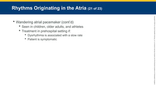 Copyright
©
2023
by
Jones
&
Bartlett
Learning,
LLC,
an
Ascend
Learning
Company
and
the
American
Academy
of
Orthopaedic
Surgeons.
Rhythms Originating in the Atria (21 of 23)
 Wandering atrial pacemaker (cont’d)
 Seen in children, older adults, and athletes
 Treatment in prehospital setting if:
 Dysrhythmia is associated with a slow rate
 Patient is symptomatic
 
