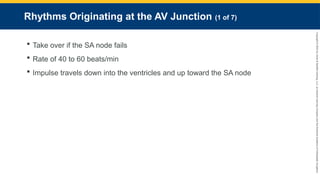 Copyright
©
2023
by
Jones
&
Bartlett
Learning,
LLC,
an
Ascend
Learning
Company
and
the
American
Academy
of
Orthopaedic
Surgeons.
Rhythms Originating at the AV Junction (1 of 7)
 Take over if the SA node fails
 Rate of 40 to 60 beats/min
 Impulse travels down into the ventricles and up toward the SA node
 