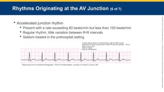 Copyright
©
2023
by
Jones
&
Bartlett
Learning,
LLC,
an
Ascend
Learning
Company
and
the
American
Academy
of
Orthopaedic
Surgeons.
Rhythms Originating at the AV Junction (6 of 7)
 Accelerated junction rhythm
 Present with a rate exceeding 60 beats/min but less than 100 beats/min
 Regular rhythm, little variation between R-R intervals
 Seldom treated in the prehospital setting
Reproduced from Arrhythmia Recognition: The Art of Interpretation, courtesy of Tomas B. Garcia, MD.
 