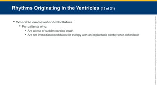 Copyright
©
2023
by
Jones
&
Bartlett
Learning,
LLC,
an
Ascend
Learning
Company
and
the
American
Academy
of
Orthopaedic
Surgeons.
Rhythms Originating in the Ventricles (19 of 21)
 Wearable cardioverter-defibrillators
 For patients who:
 Are at risk of sudden cardiac death
 Are not immediate candidates for therapy with an implantable cardioverter-defibrillator
 